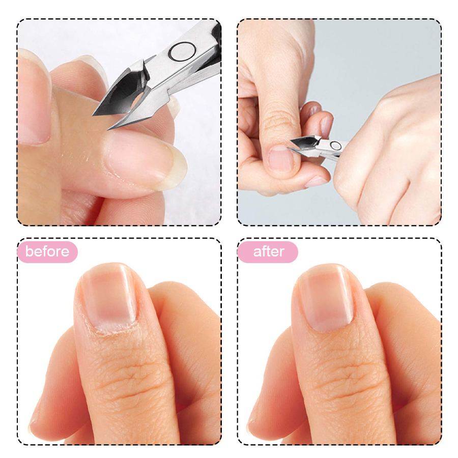 10ml pre-treatment solution