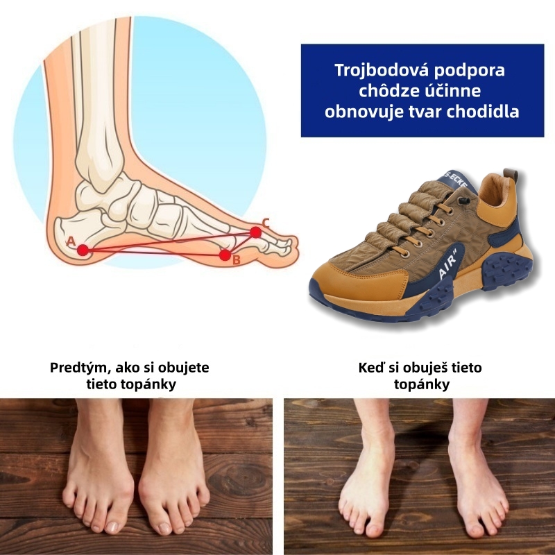 🔥Uvedenie nového produktu na trh, časovo obmedzená 70% zľava dnes⏰Ergonomický dizajn, vynikajúce tlmenie nárazov, koriguje chôdzu