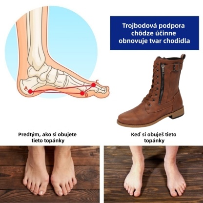 Dámske topánky