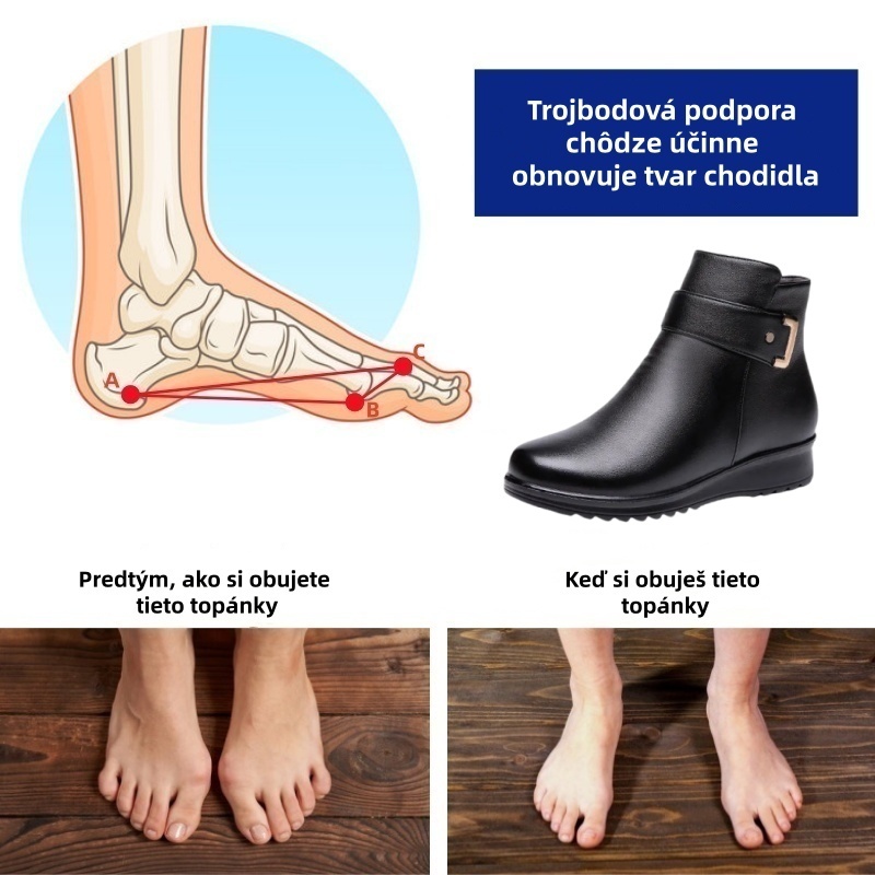 (🔥Dnes zľava 50 % - nepremeškajte túto príležitosť) ⏰ - Mäkké a pohodlné dámske kožené topánky z pravej vlny (podpora klenby - uľahčuje chôdzu)