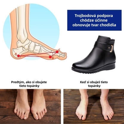 (🔥Dnes zľava 50 % - nepremeškajte túto príležitosť) ⏰ - Mäkké a pohodlné dámske kožené topánky z pravej vlny (podpora klenby - uľahčuje chôdzu)