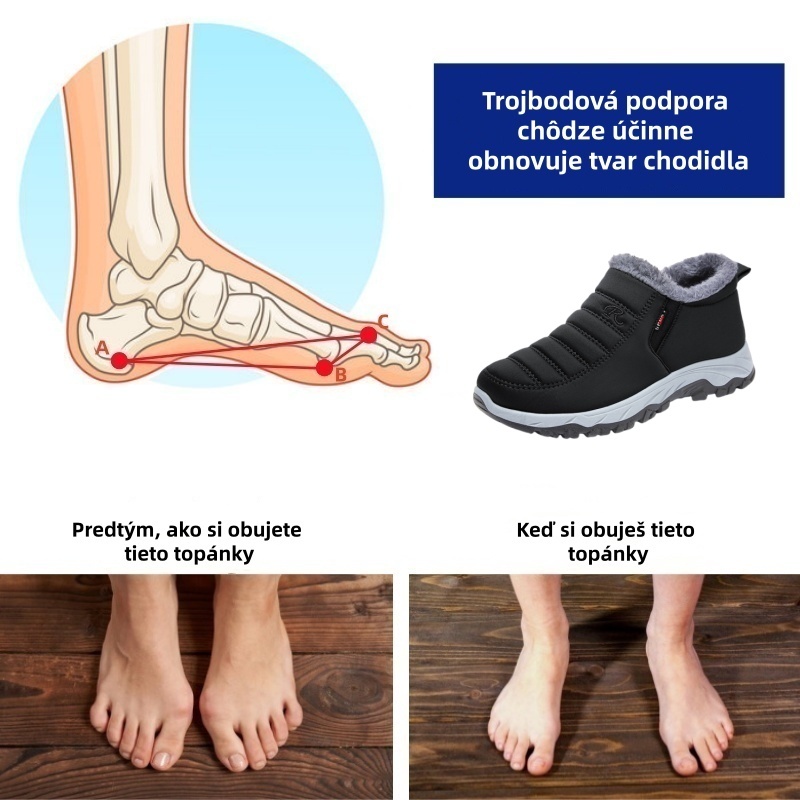 [🔥Dnes za polovičnú cenu - Nenechajte si to ujsť] Ergonomicky navrhnutá ortopedická obuv - dizajn s podporou klenby 👞 Ľahko sa zbavte bolesti chodidiel 