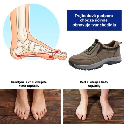 [🔥Dnes za polovičnú cenu - Nenechajte si to ujsť] Ergonomicky navrhnutá ortopedická obuv - dizajn s podporou klenby 👞 Ľahko sa zbavte bolesti chodidiel 