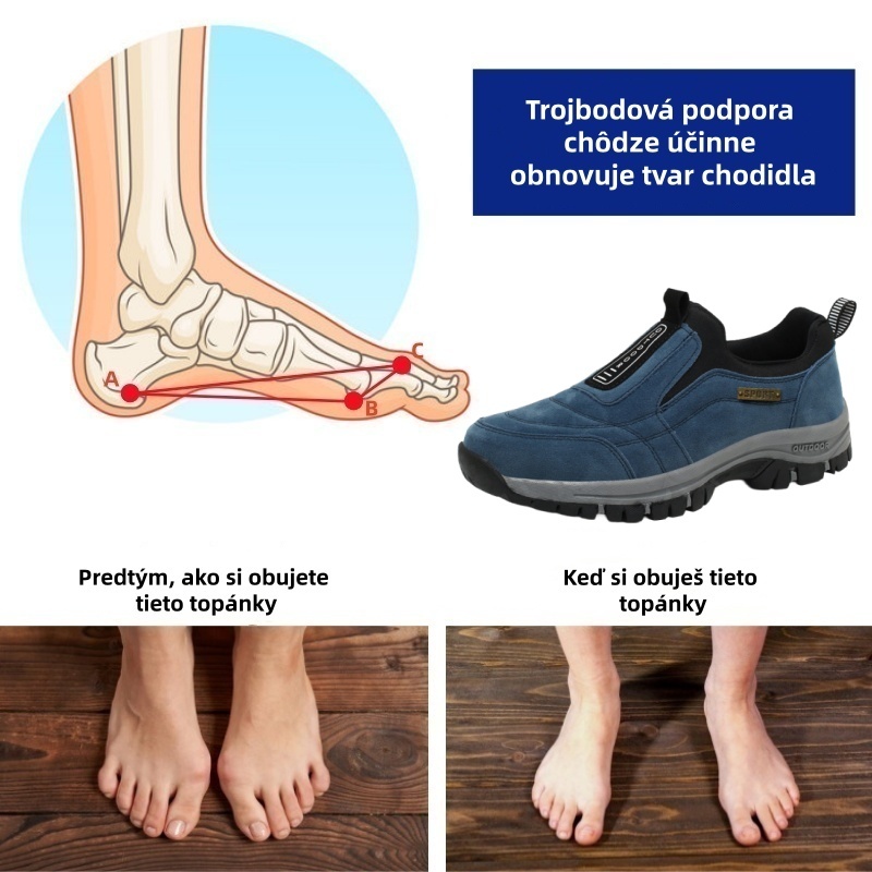 [🔥Dnes za polovičnú cenu - Nenechajte si to ujsť] Ergonomicky navrhnutá ortopedická obuv - dizajn s podporou klenby 👞 Ľahko sa zbavte bolesti chodidiel