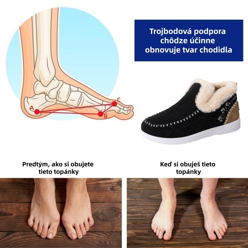 (🔥70% zľava dnes - nenechajte si ujsť túto príležitosť) ⏰ - Mäkké a pohodlné, originálne vlnené dámske bavlnené topánky (podpora klenby - uľahčuje chôdzu)