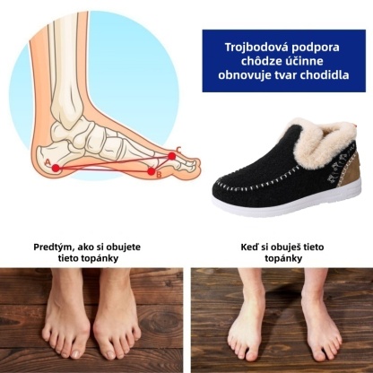 (🔥70% zľava dnes - nenechajte si ujsť túto príležitosť) ⏰ - Mäkké a pohodlné, originálne vlnené dámske bavlnené topánky (podpora klenby - uľahčuje chôdzu)