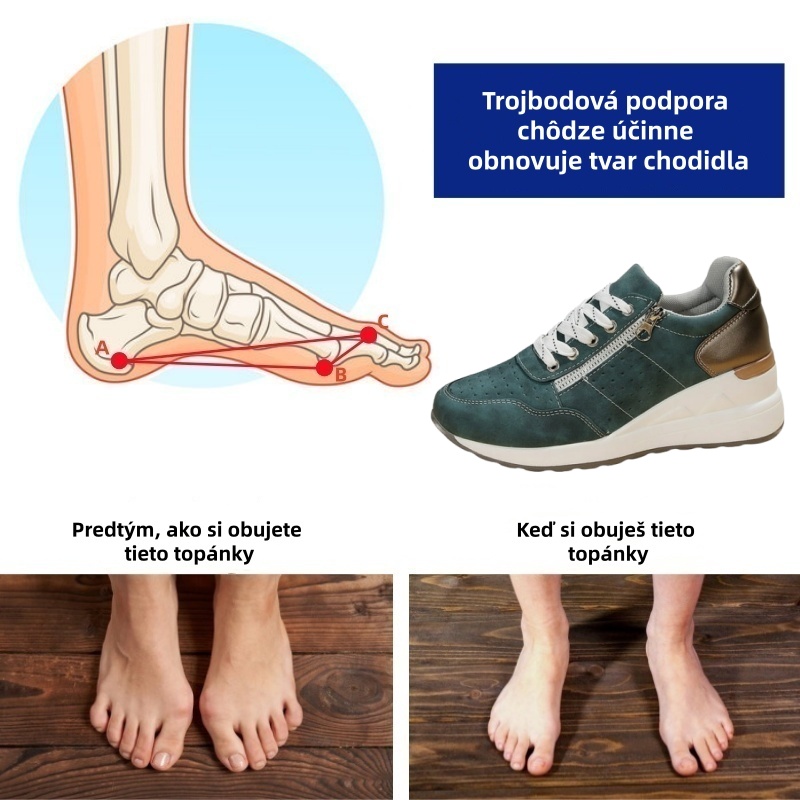 [🔥Dnes za polovičnú cenu - Nenechajte si to ujsť] Ergonomicky navrhnutá ortopedická obuv - dizajn s podporou klenby 👞 Ľahko sa zbavte bolesti chodidiel