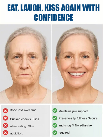 [No glue, no boiling required, Try at home, no appointments needed] Full-mouth bone-supported denture set