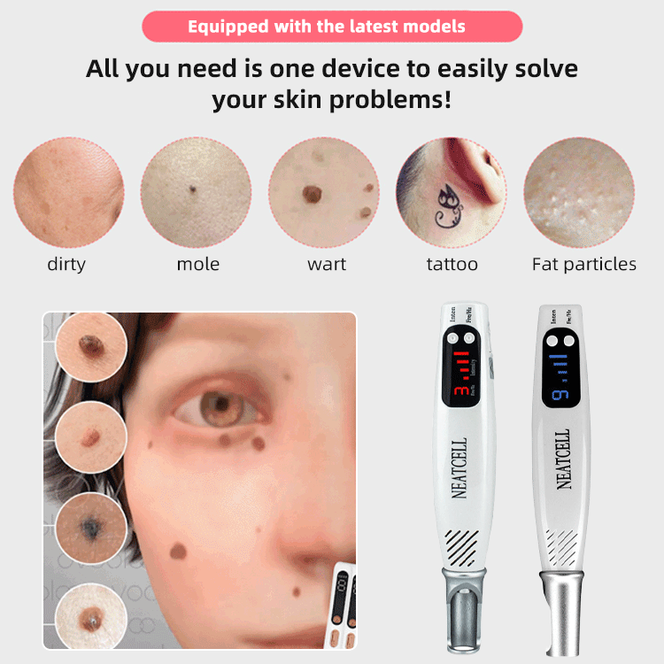 Mikro anyajegy eltávolító szemölcs eltávolító tetováló lézertoll