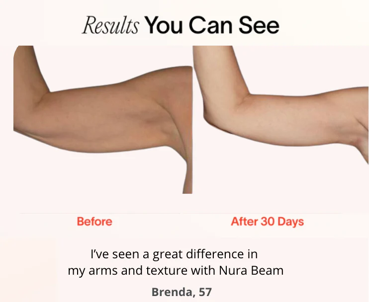 Klynein™ Arm Bands