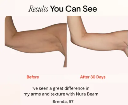 Klynein™ Arm Bands