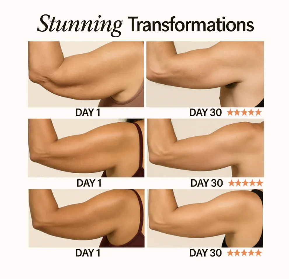 Klynein™ Arm Bands