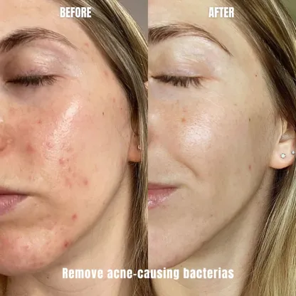 Neermaison cleaner™ - Makeup Brush Cleaner