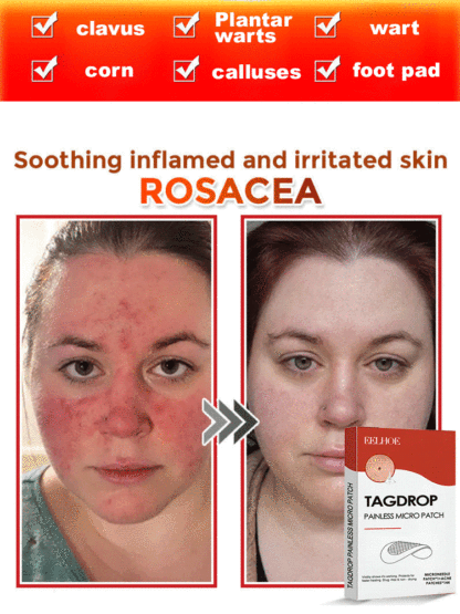 ✨Painless and non-invasive, a substitute for cosmetic procedures, can be done at home. Say goodbye to surgery, lasers, and cryotherapy. 0 pain, 0 scars, and no recovery period. ✅