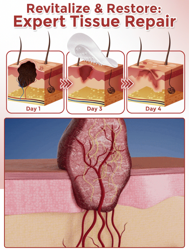 ✨Painless and non-invasive, a substitute for cosmetic procedures, can be done at home. Say goodbye to surgery, lasers, and cryotherapy. 0 pain, 0 scars, and no recovery period. ✅