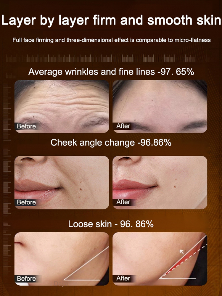 Medical-grade anti-wrinkle treatment 🏆 Recommended by plastic surgeons! Reduces tear troughs + brightens the eye area, firms eye muscles without irritation