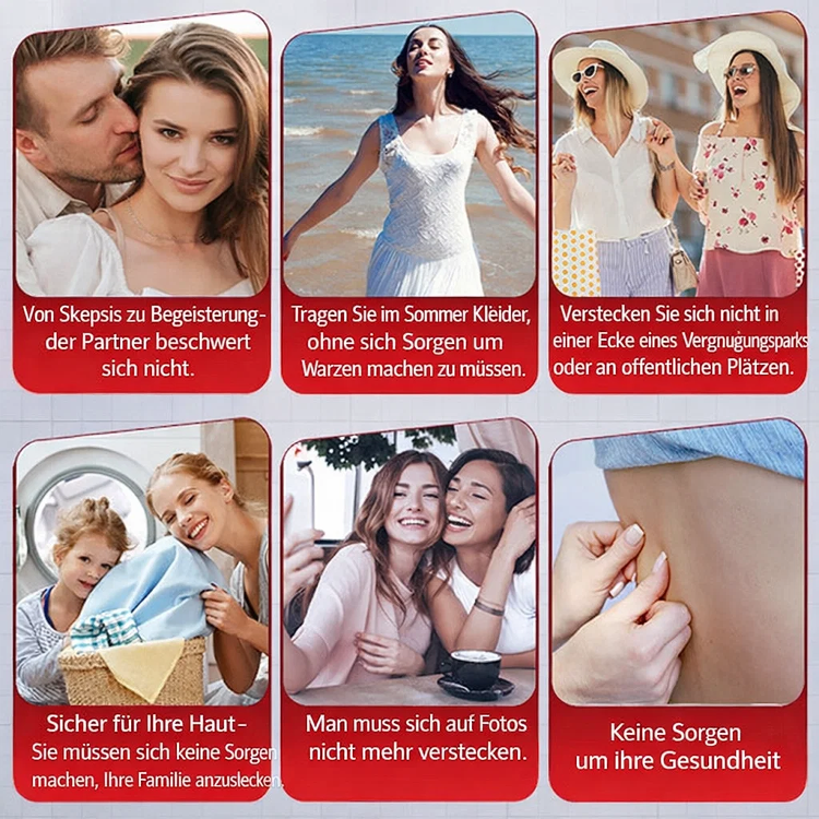 【Eine-Sekunde-Warzenentfernung】Warzenentfernungssalbe