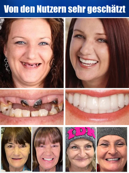 Holen Sie sich Ihr strahlendes Lächeln zurück – ganz ohne Zahnarztbesuch! ✨ Unsere innovativen Flex-Veneers lassen sich in nur 3 Minuten perfekt an Ihre Mundform anpassen.