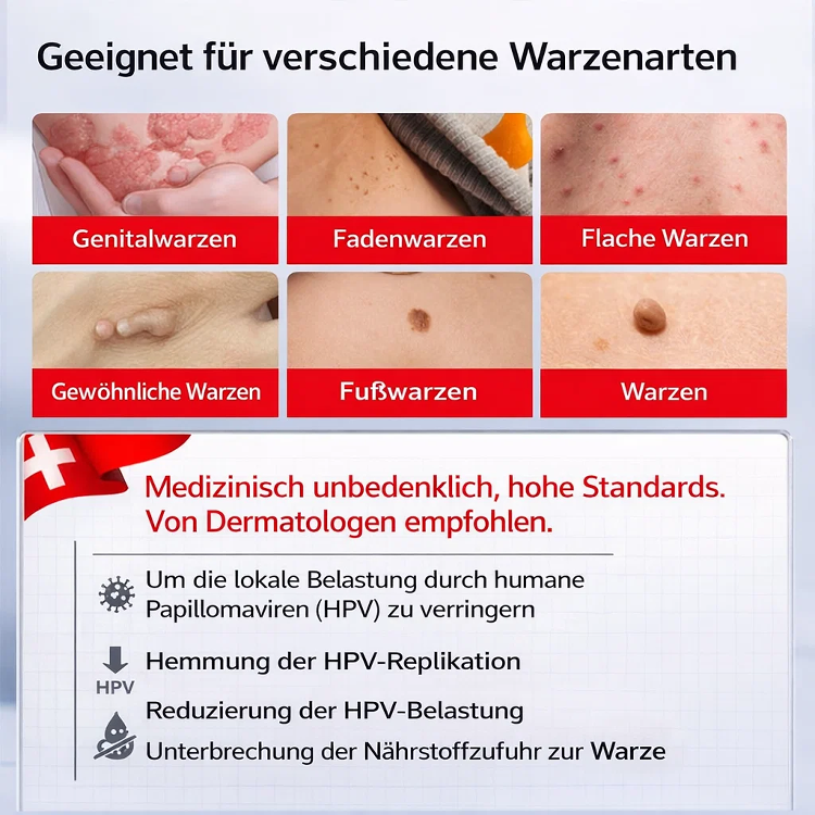 【Eine-Sekunde-Warzenentfernung】Warzenentfernungssalbe