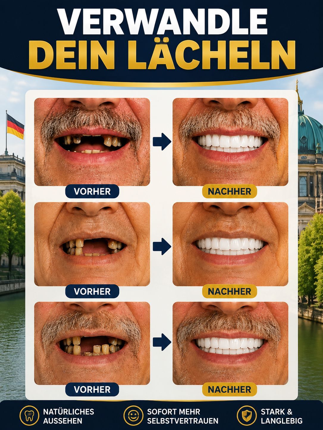 ✨ Dein perfektes Lächeln in 3 Minuten! Verabschiede dich von teuren Zahnarztbesuchen. Diese DIY-Silikon-Veneers lassen sich ganz einfach zu Hause anpassen – für ein natürliches Lächeln.