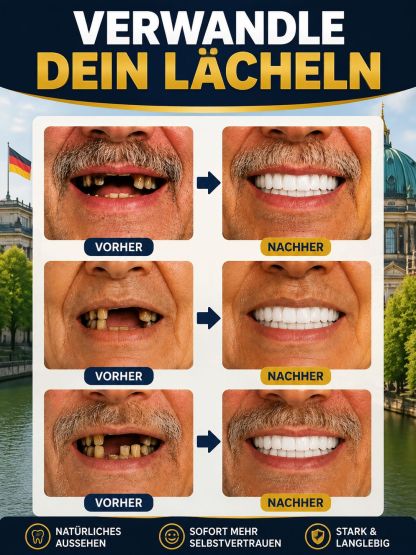 ✨ Dein perfektes Lächeln in 3 Minuten! Verabschiede dich von teuren Zahnarztbesuchen. Diese DIY-Silikon-Veneers lassen sich ganz einfach zu Hause anpassen – für ein natürliches Lächeln.