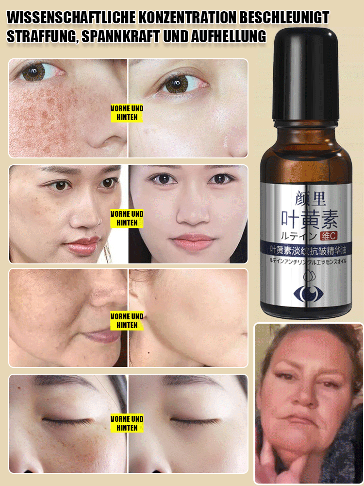 ✨ 7 Tage junge Augenpartie wiederherstellen! ✨ Transdermales Lutein-Vitamin-C-Anti-Aging-Augenöl