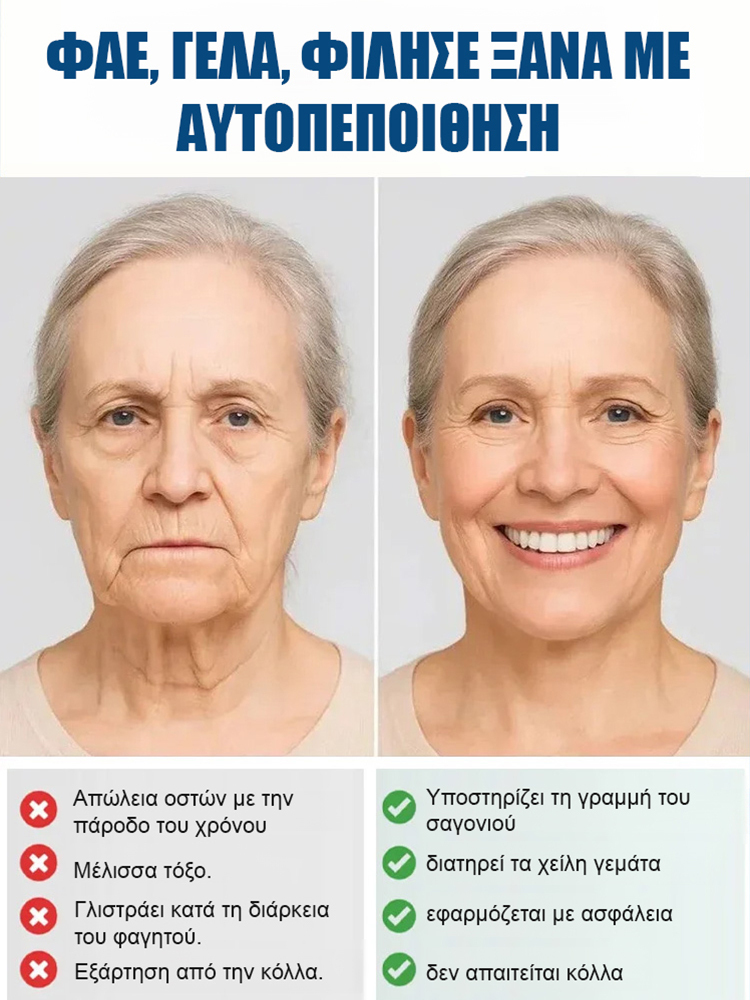 Παγκοσμίως πάνω από 300.000 χρήστες Ολική Οδοντοστοιχία με Σκελετική Στήριξη