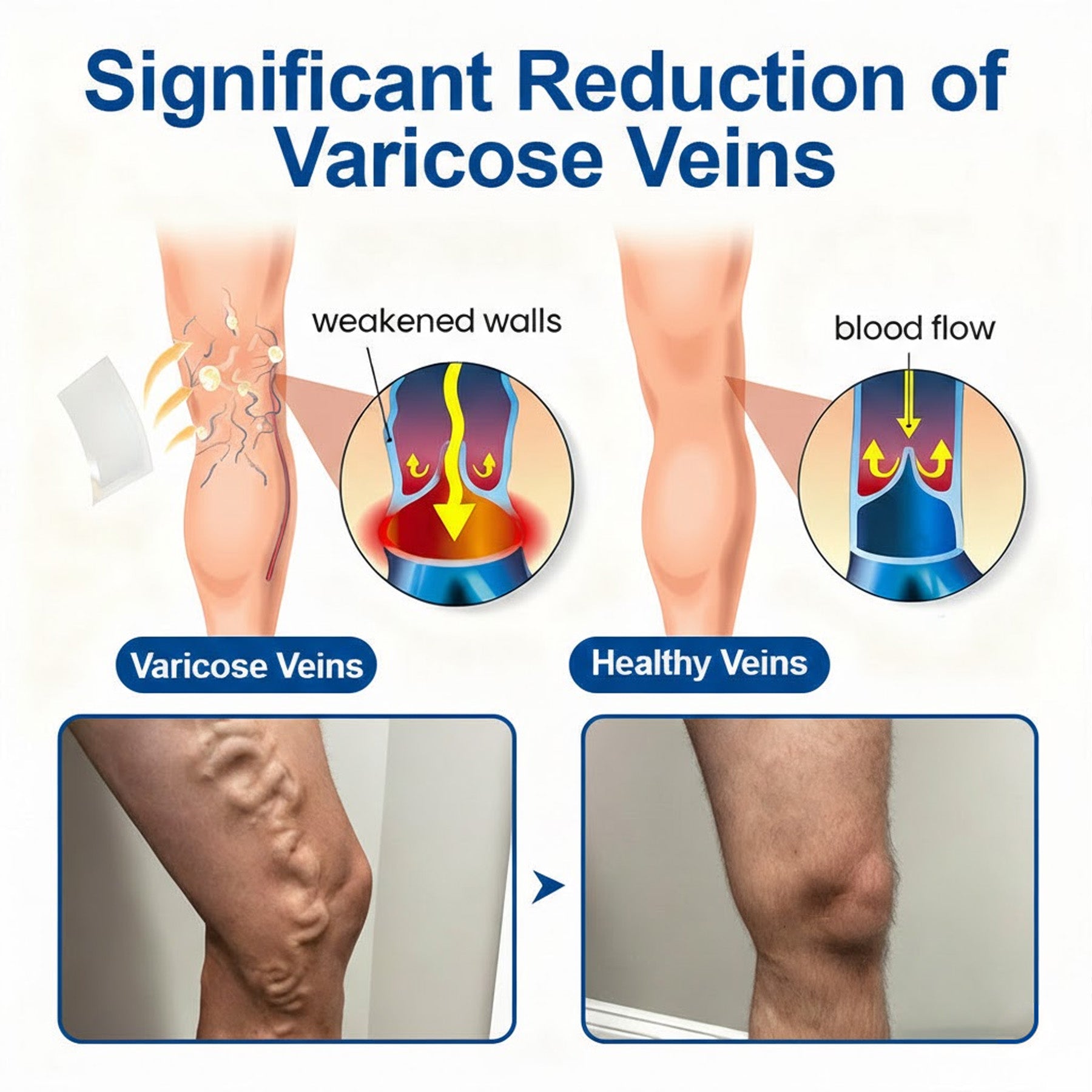 🇺🇸👨‍⚕️✅classicusaoffer® VeinEase Microneedle Care Patch⚡Instant Relief, Long-Term Results