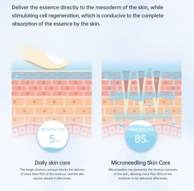 Dr. Pen A11 Ultima PRO Microneedling Pen