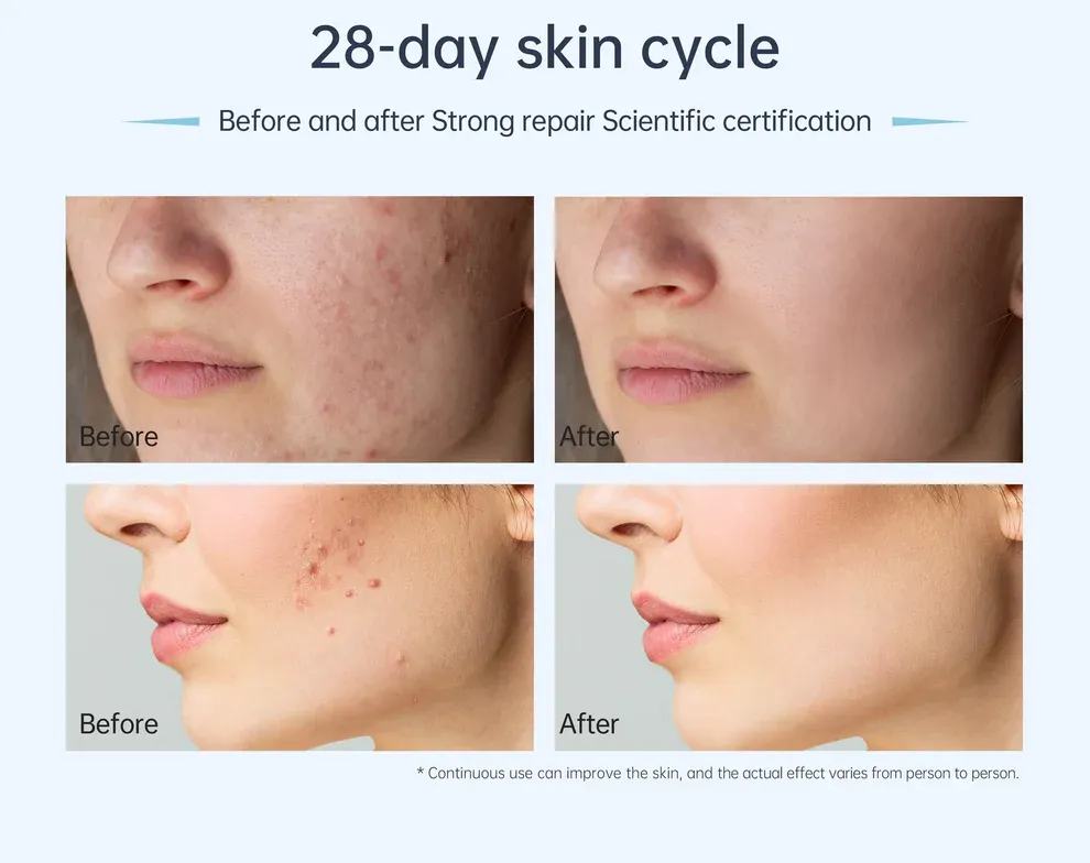 Dr. Pen A11 Ultima PRO Microneedling Pen