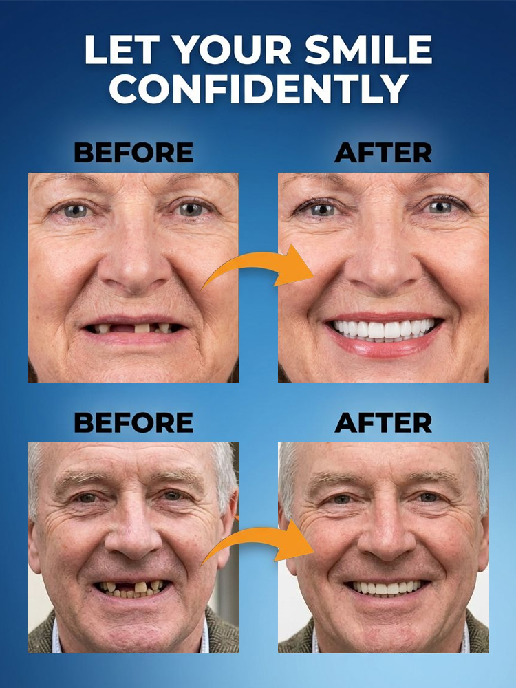 New generation of customized full-function dentures