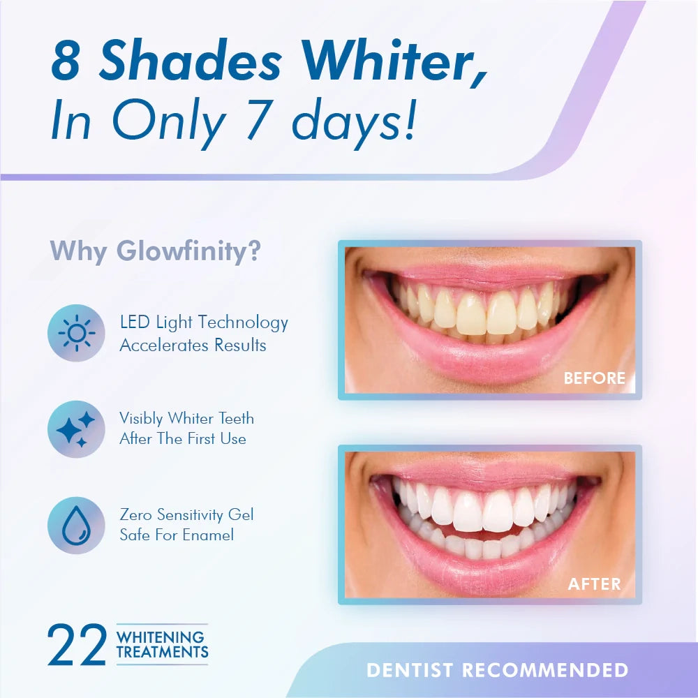 Teeth Whitening Kit