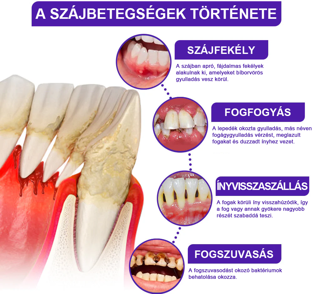 🌟Zubná pasta Rolimey® VioCore s včelím jedom