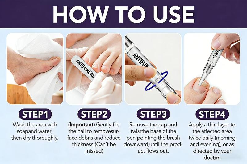 抗真菌护理笔 &ndash; 适用于受损指甲和足部真菌感染指甲，含25%十一烯酸和茶树油，强效趾甲真​​菌修复笔