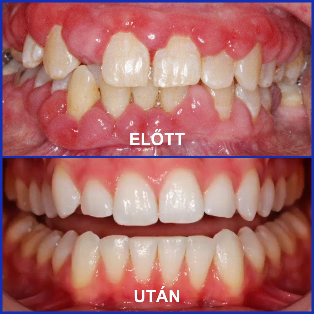 🌟Zubná pasta Rolimey® VioCore s včelím jedom