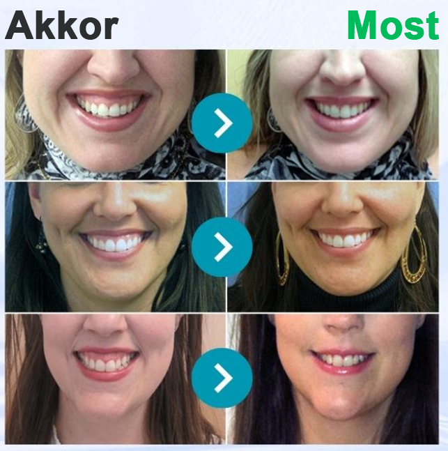 🌟Zubná pasta Rolimey® VioCore s včelím jedom