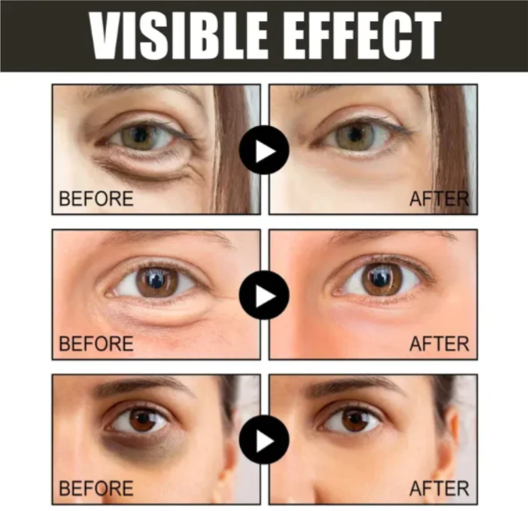 【Čierny piatok, zľava 50 %】Kofeínový očný krém