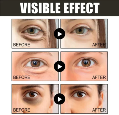 【Čierny piatok, zľava 50 %】Kofeínový očný krém