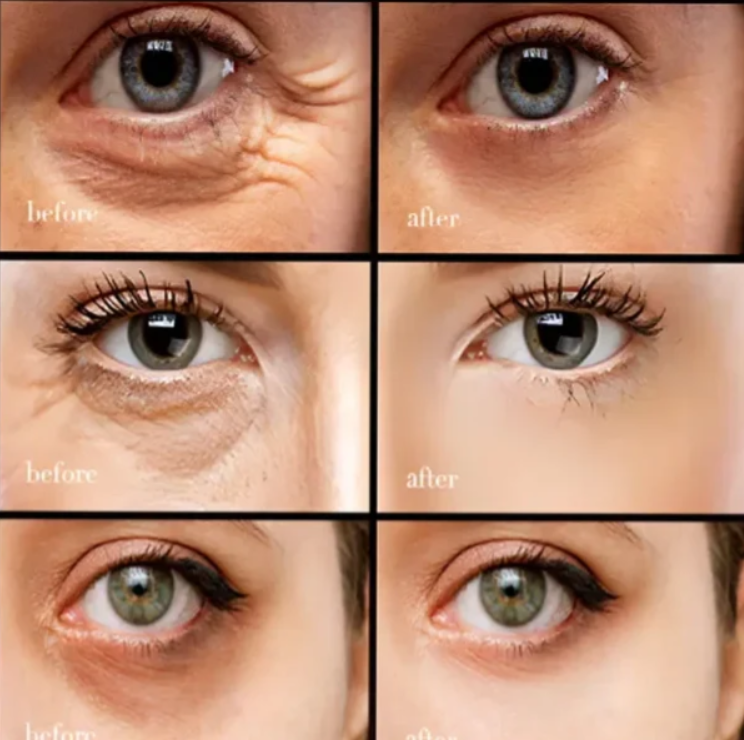 【Čierny piatok, zľava 50 %】Kofeínový očný krém