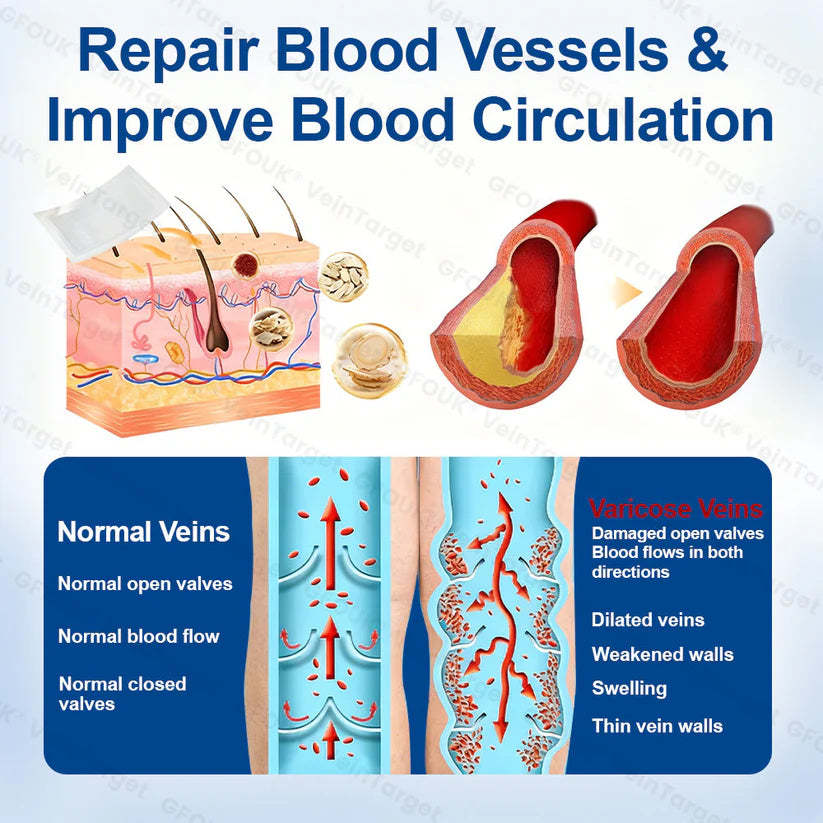 🇦🇺💧👩‍🔬GFOUK® VeinTarget Microneedle Patch⚡Instant Relief, Long-Term Results