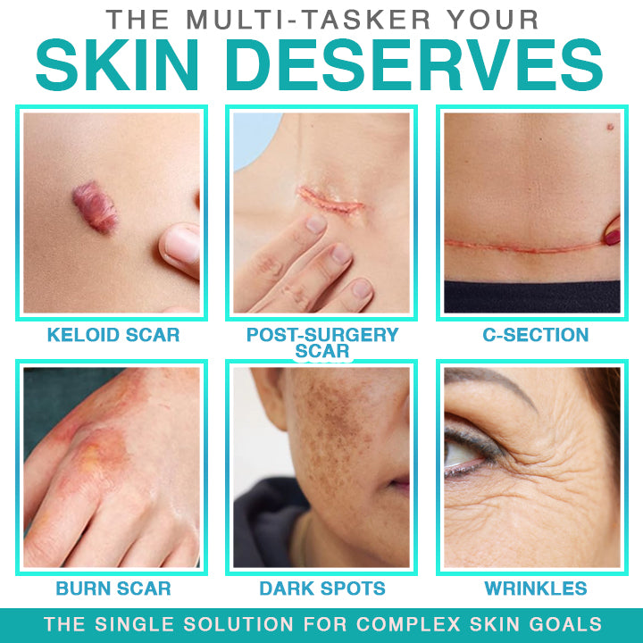 𝗖𝗮𝗿𝗲𝗕𝗿𝗲𝗲𝘇𝗲® 3-in-1 Microneedle Care Patch