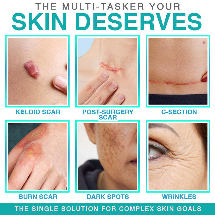 𝗖𝗮𝗿𝗲𝗕𝗿𝗲𝗲𝘇𝗲® 3-in-1 Microneedle Care Patch