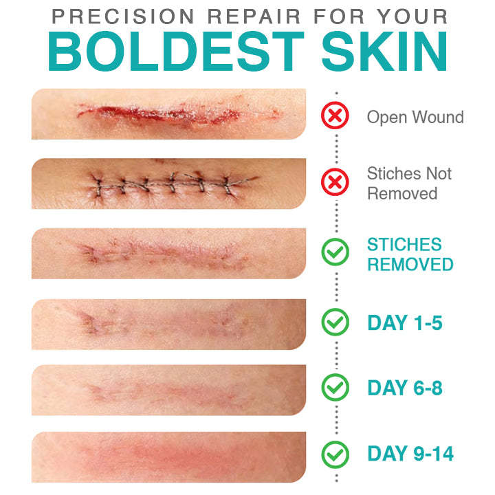 𝗖𝗮𝗿𝗲𝗕𝗿𝗲𝗲𝘇𝗲® 3-in-1 Microneedle Care Patch