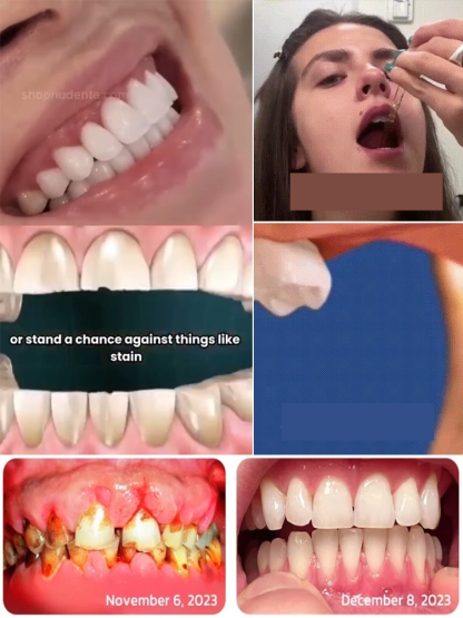 Zahnregenerationspflegemittel-Tropfen