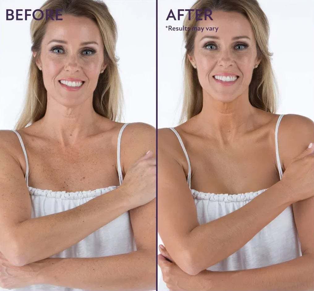 🏆Only $18.99🔥Last Day Promotion! - All Over Complexion Perfector