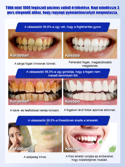 Ne hagyd, hogy a fogfolt elrontsa a mosolyodat!