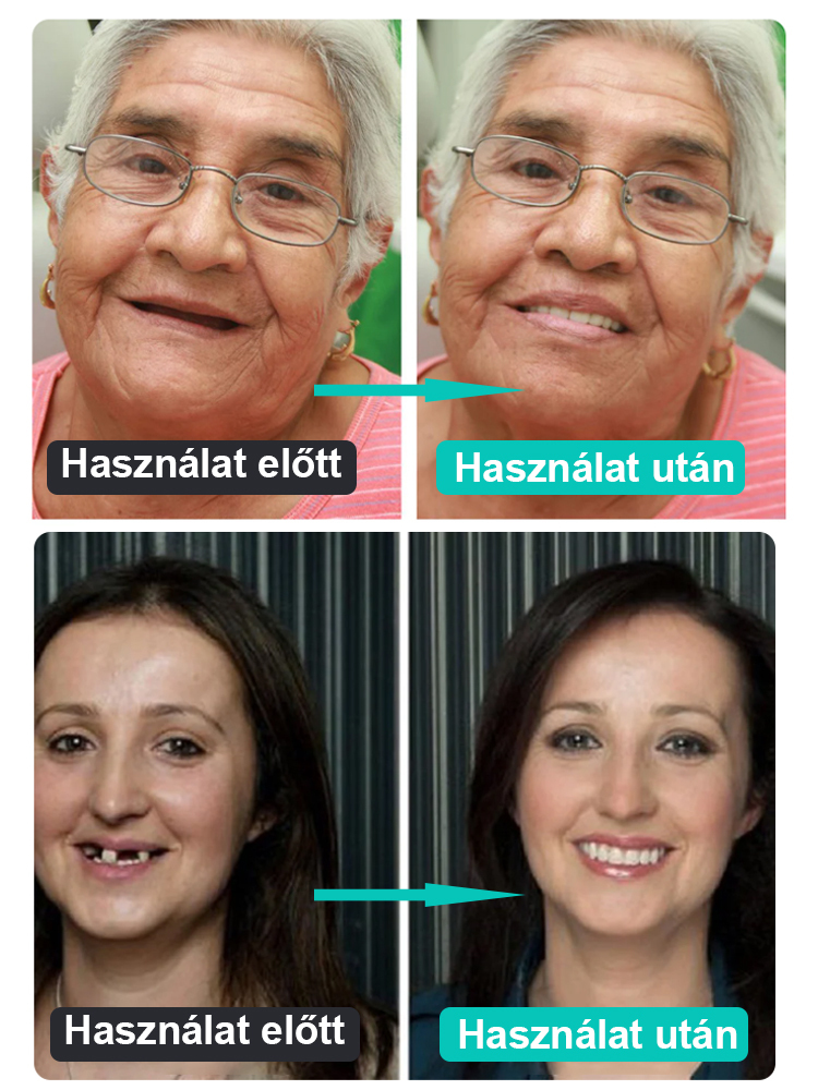 Két perc alatt visszanyered mosolyodat! 👦 Búcsú a drága fogorvosi díjaktól!