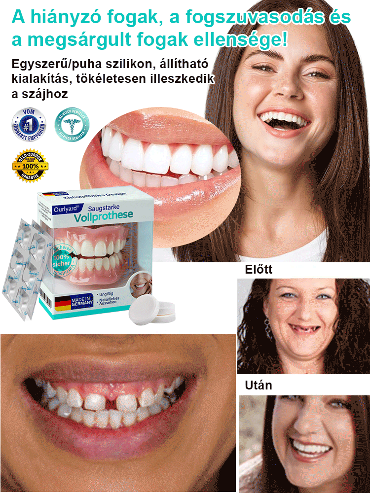 Két perc alatt visszanyered mosolyodat! 👦 Búcsú a drága fogorvosi díjaktól!