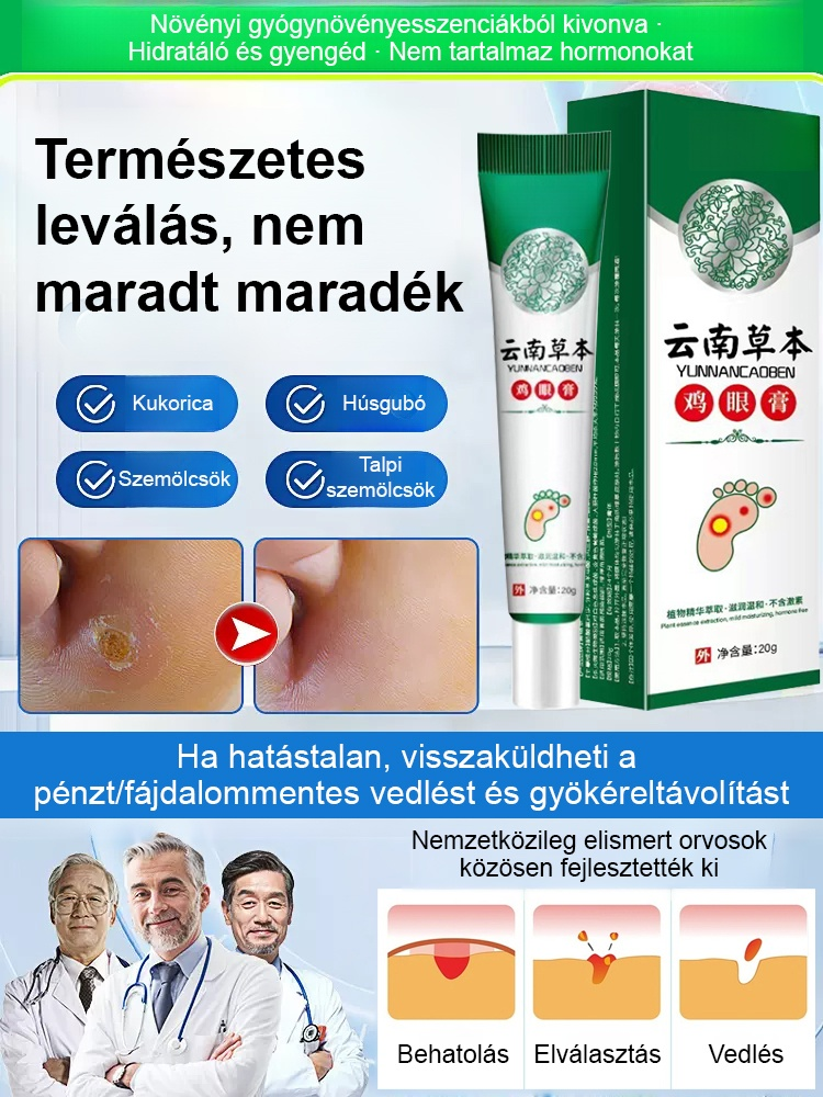 💥7 nap alatt fájdalommentes gyógynövényes krém a tyúkszem ellen 🦶 Búcsú a fájdalmas járástól, nem hagy hegeket ✨