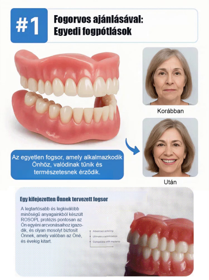 🦷Próbálja ki ezt a komplett fogpótlás-készletet, amelyet orvosi egyetem fejlesztett ki és orvosi egyetem tanúsított – beépített fogkefét és fogkrémet tartalmaz a mindennapi ápoláshoz!
